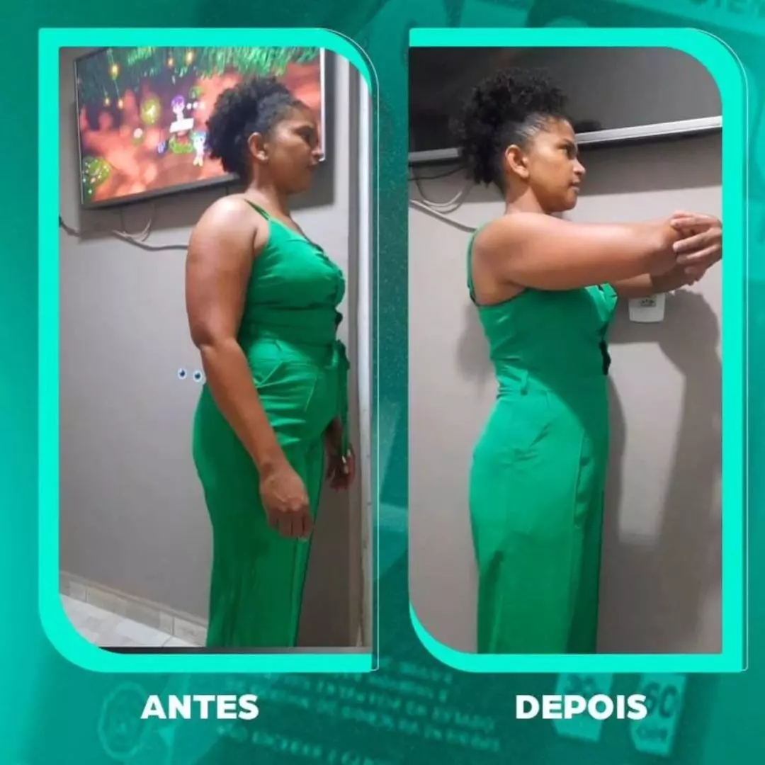 Antes e depois — transformação 1