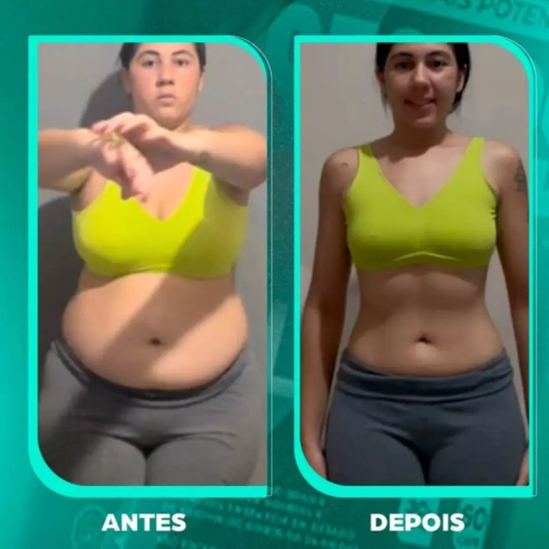 Antes e depois — transformação 2
