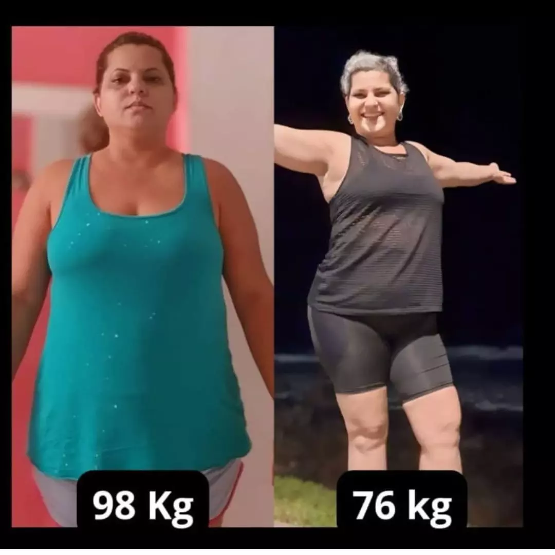 Antes e depois — transformação 3