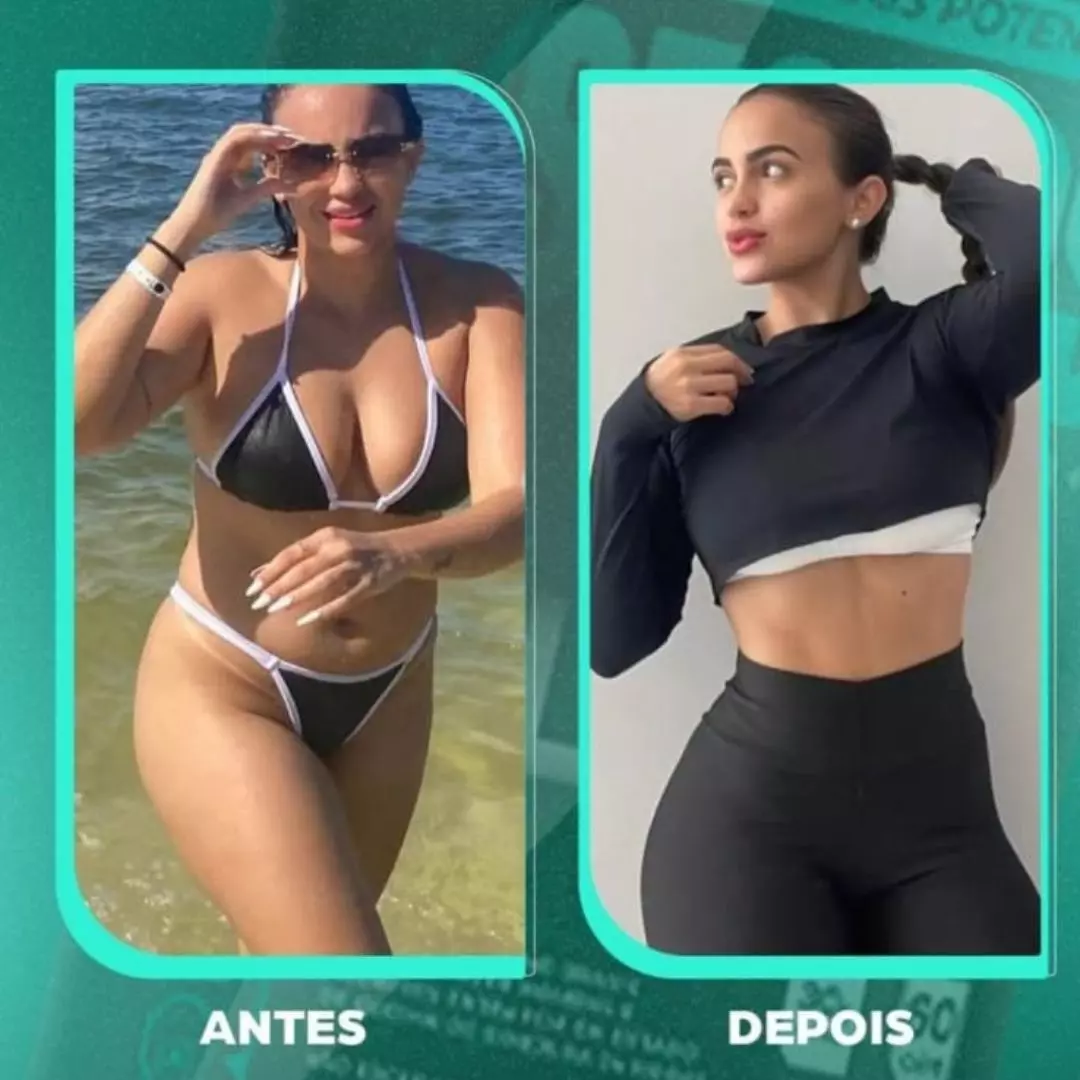 Antes e depois — transformação 4